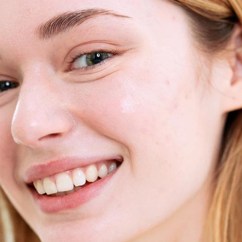 product_image_name-SVR-Ampoule AZ Sebiaclear Ampoule Flash 30 30 ml-3