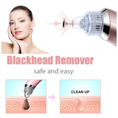 product_image_name-Aprilla-مكنسة كهربائية لتنظيف الرؤوس السوداء ، سهلة الاستخدام.-4