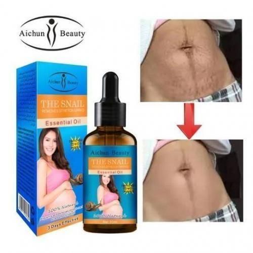product_image_name-Generic-Aichun Beauty Huile d'escargots pour massage pour les vergetures utilisé au corps ventre et hanches-1
