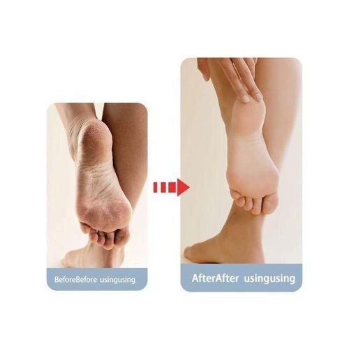 product_image_name-Generic-Gants hydratantes avec chaussettes exfoliantes pour SPA, Réparation de la Peau de pieds et mains-6
