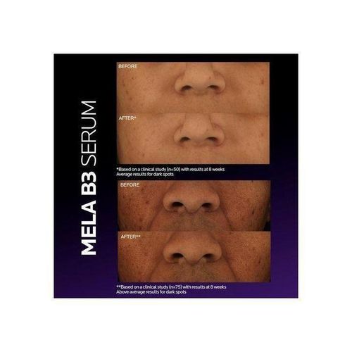 product_image_name-La Roche Posay1-Mela B3 Sérum Concentré Intensif Anti-Taches Anti-Récidive – 30ml-3