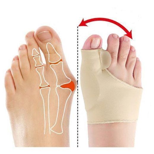 Generic 1 Paire Correcteur d'Oignon Hallux Valgus et Redresseur d'Orteils en Gel, pour Hommes et Femmes