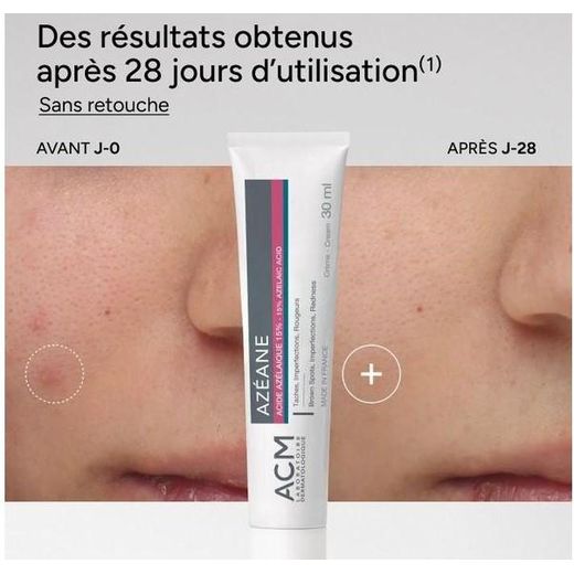 ACM AZEANE crème 15% Acide Azélaique 30ml