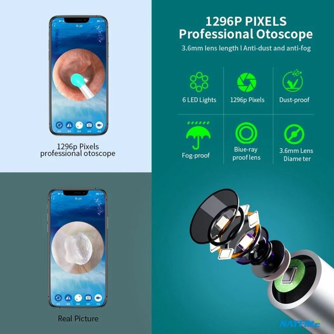 SUNUO P40-B Otoscope Nettoyeur d'Oreilles Visuel Intelligent en