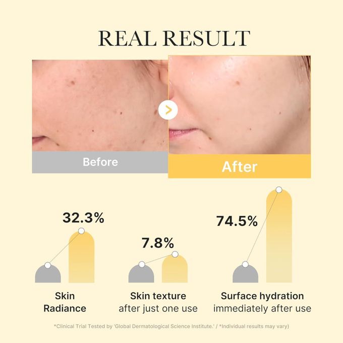 Masque Facial Medicube à L’acide Kojique Et Curcuma – Soin Illuminant 28g Pour Une Peau éclatante
