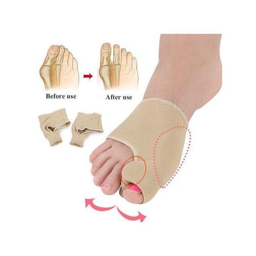 Non retournableCoussin correcteur d'orteils,protection pour Hallux Valgus,outils de soins des pieds, 2 Pièces