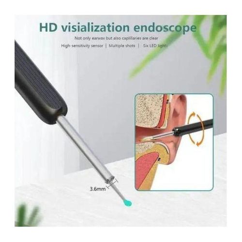 Nettoyeur d’Oreille Visuel Intelligent Sans Fil avec Caméra – Endoscope Auriculaire WiFi, Kit de Nettoyage Auriculaire
